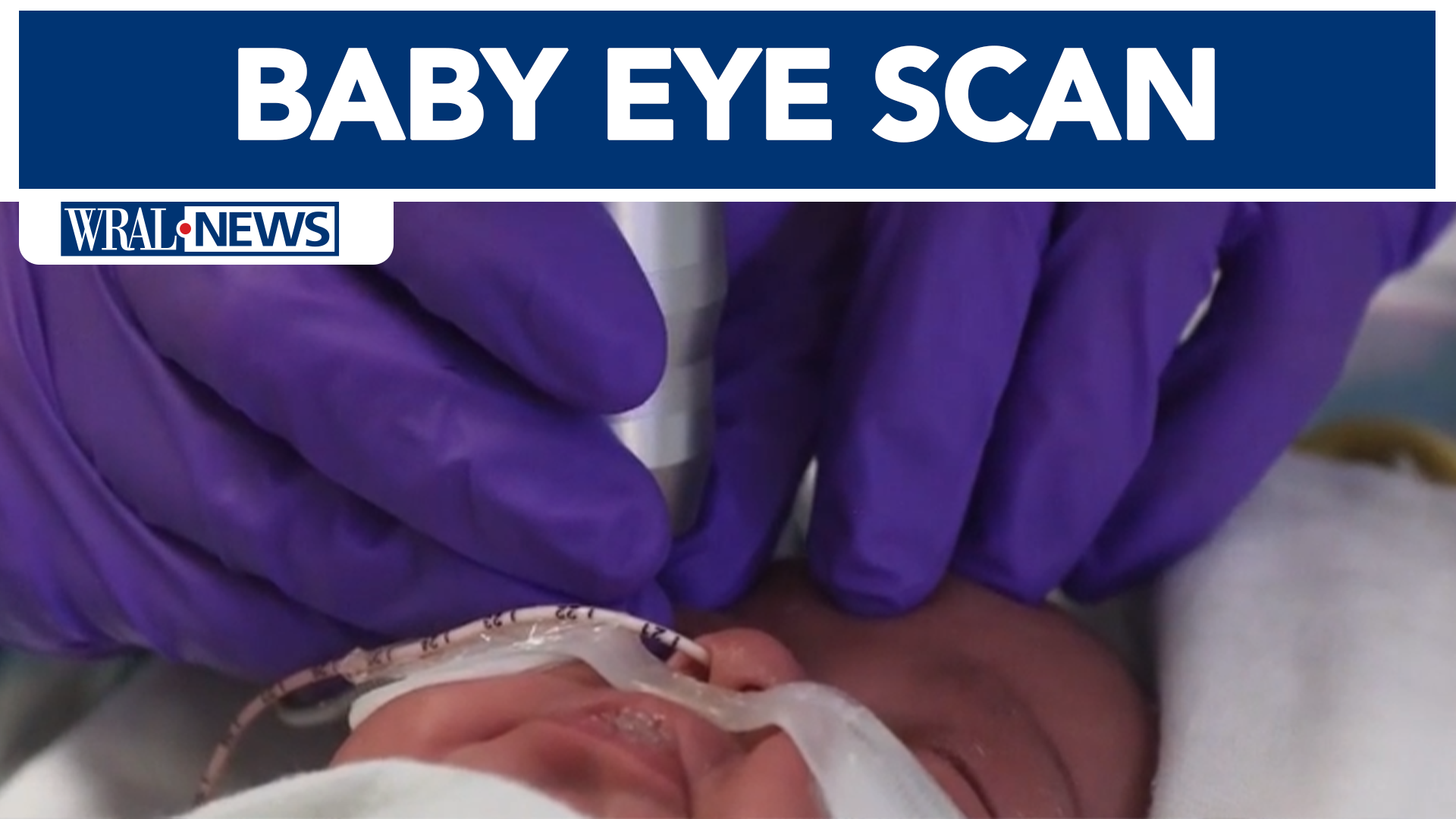 Baby eye scan could predict developmental delays